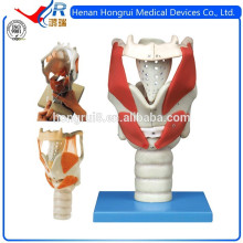 ISO Advanced Laryngeal Anatomisches Modell